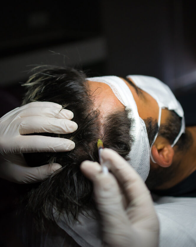 Hair Rejuvenation