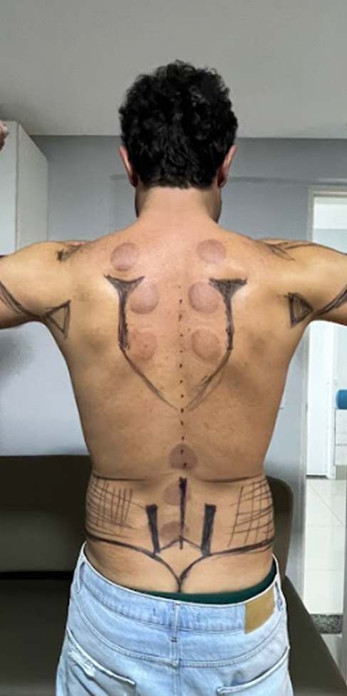 TLC Medspa